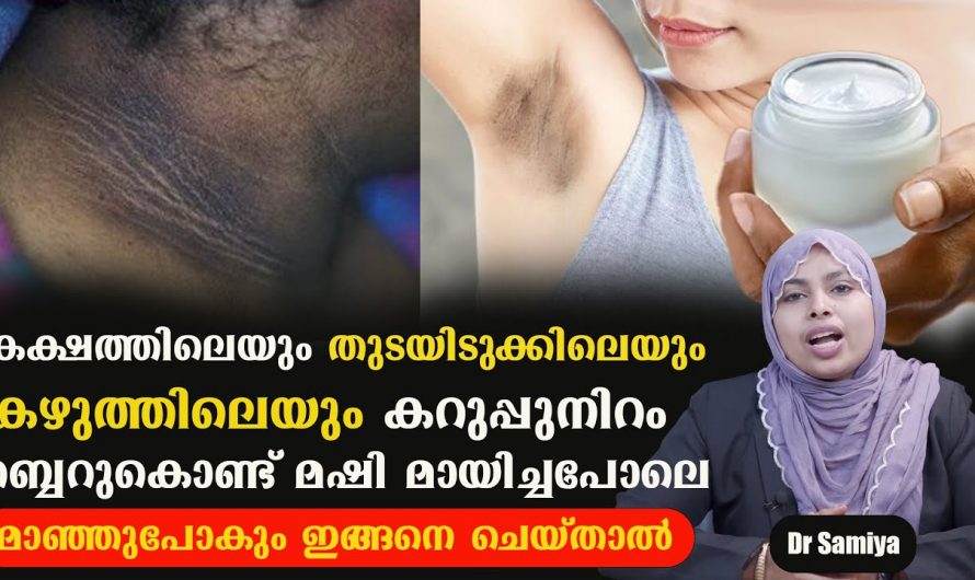 കറുത്ത പാടുകൾ നീക്കം ചെയ്യാൻ ഇത്രമാത്രം ചെയ്താൽ മതി. ഇത് ആരും കാണാതെ പോകരുതേ…| Black mark in body