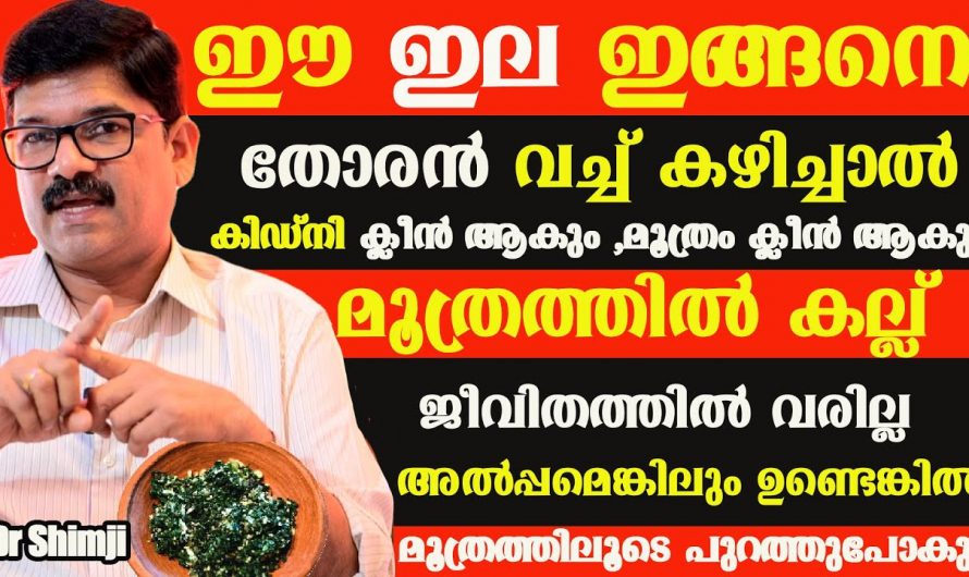 നമ്മുടെ ദൈനംദിനം ജീവിതത്തെ ബാധിക്കുന്ന കിഡ്നി സ്റ്റോണുകളെ കുറിച്ച് കൂടുതൽ അറിഞ്ഞ് അതിന് പ്രതിരോധിക്കാനായി വീഡിയോ കാണുക.