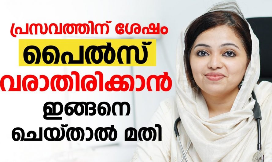 പ്രസവത്തിനു ശേഷമുള്ള പൈൽസ് എന്ന രോഗാവസ്ഥയെ മറി കടക്കാൻ ഇക്കാര്യങ്ങൾ ആരും കാണാതെ പോകരുതേ…| Piles After Pregnancy