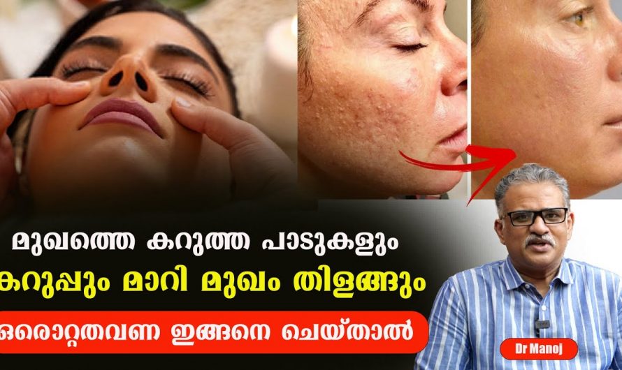 മുഖത്തെ കറുത്ത പാടുകളിൽ ഇനി നിങ്ങൾ ആകുലരാകേണ്ട. ഇതിനുള്ള പ്രതിവിധി ഇതാ ഇവിടെയുണ്ട് കണ്ടു നോക്കൂ…| What causes facial darkness