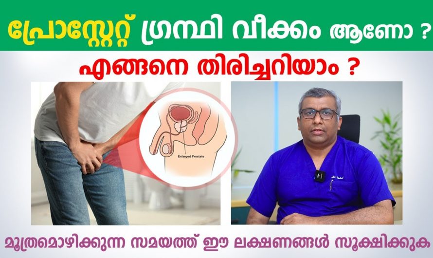 ഈ രോഗാവസ്ഥകളെ തിരിച്ചറിയാൻ ഇത്തരം ലക്ഷണങ്ങൾ തന്നെ ധാരാളം. ഇത് ആരും അറിയാതെ പോകരുതേ…| Prostate Disease Malayalam