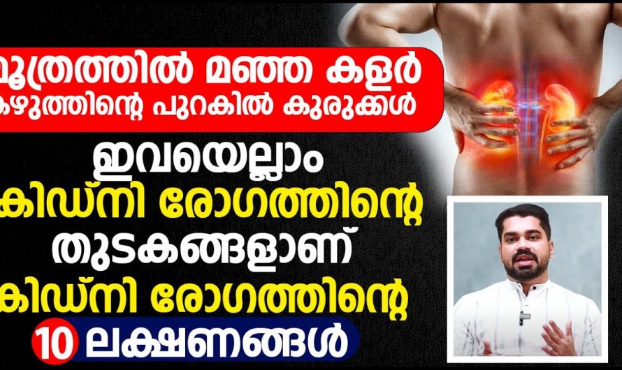 നിങ്ങളിൽ കാണുന്ന ഇത്തരം ലക്ഷണങ്ങളെ  നിസ്സാരമായി കാണരുതേ. ഇത് നിങ്ങളെ ജീവന് തന്നെ ഭീഷണിയാണ് കണ്ടു നോക്കൂ…| 10 Symptoms of Kidney Disease