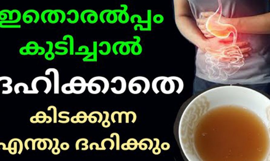 ദഹനക്കേട് മൂലം ഉണ്ടാകുന്ന അസ്വസ്ഥതകളെ ഇനി ഭയപ്പെടേണ്ട. ഇതിനെ മറികടക്കാൻ ഇത്തരം കാര്യങ്ങൾ ആരും അറിയാതെ പോകരുതേ…| Indigestion Treatment