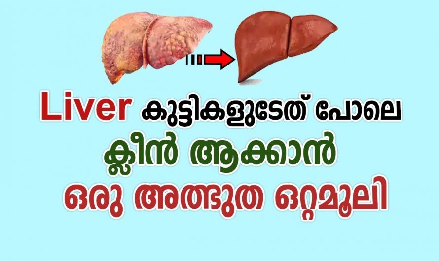 കരളിനെ രോഗ മുക്തി നേടാൻ ഇതാ ഒരു അൽഭുത  മരുന്ന്. ഇതിന്റെ ഉപയോഗം ആരും അറിയാതെ പോകരുതേ…| 7 signs your liver is dying