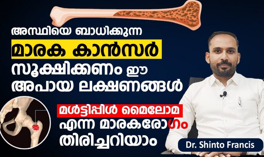 അസ്ഥികളിൽ ഉണ്ടാകുന്ന ക്യാൻസറുകൾക്ക് ശരീരം കാണിച്ചു തരുന്ന ലക്ഷണങ്ങളെ ആരും അറിയാതെ പോകരുതേ…| Bone cancer symptoms malayalam