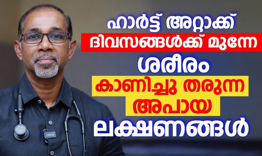 ഹാർട്ട് അറ്റാക്ക് മൂലം ഉണ്ടാകുന്ന നെഞ്ച് വേദനയെ തിരിച്ചറിയാനായി ഇത്തരം കാര്യങ്ങൾ അറിഞ്ഞേ മതിയാവൂ. ഇതാരും കാണാതെ പോകരുതേ…| How to prevent heart attack