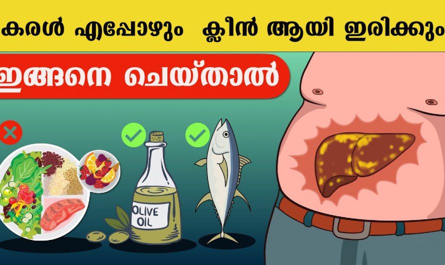 കരൾ ശസ്ത്രക്രിയകളെ കുറയ്ക്കാൻ കരളിനെ പൂർണമായും ക്ലീൻ ചെയ്യാം. ഇത്തരം കാര്യങ്ങൾ ആരും കണ്ടില്ല എന്ന് നടിക്കരുതേ…| To reduce liver surgeries