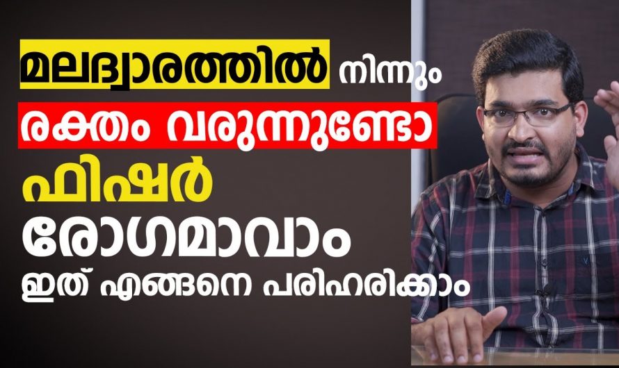 മലദ്വാരത്തിലൂടെ രക്തം വരുന്നത് എല്ലാം പൈൽസിന്റെ തുടക്കമാണോ? കണ്ടു നോക്കൂ…| Fissure treatment in malayalam