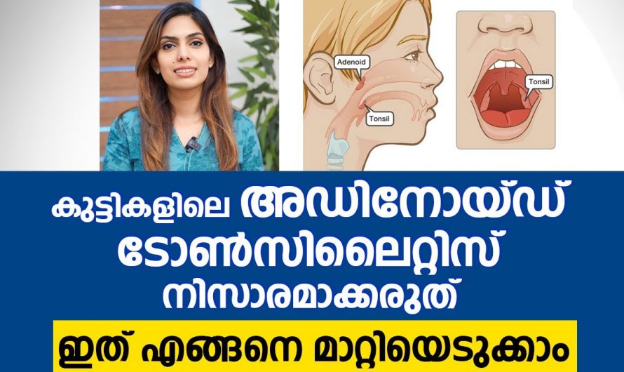 കുട്ടികളിൽ വിട്ടുമാറാത്ത തൊണ്ടവേദന ജലദോഷം മൂക്കടപ്പ് എന്നിവയുടെ യഥാർത്ഥ കാരണങ്ങളെ ആരും തിരിച്ചറിയാതെ പോകരുതേ…| Adenoid Tonsil Malayalam