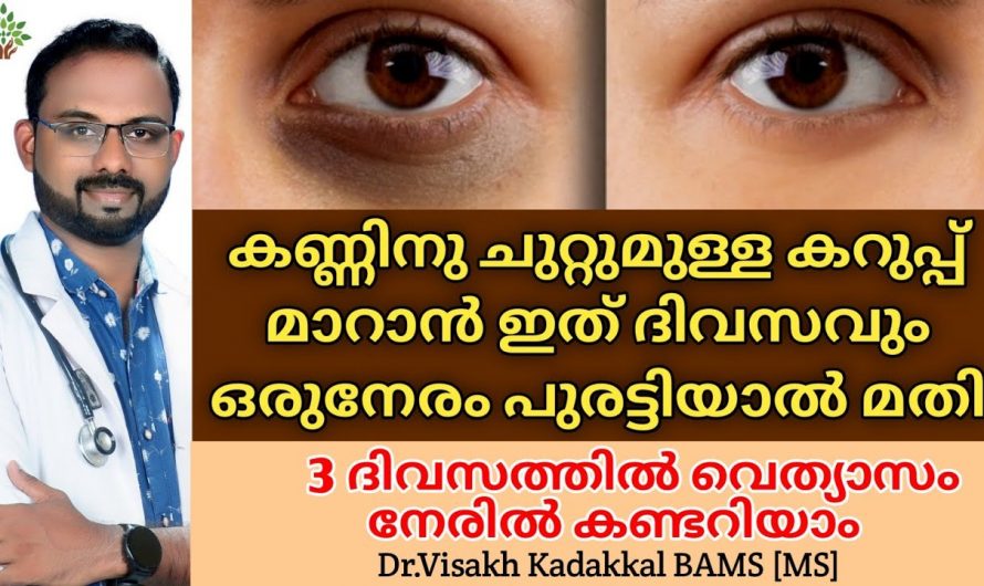 കണ്ണിന് ചുറ്റുമുള്ള കറുപ്പ് നിങ്ങളുടെ സൗന്ദര്യത്തെ ബാധിക്കുന്നുണ്ടോ? എങ്കിൽ ഇത് ഉപയോഗിക്കൂ. മാറ്റങ്ങൾ തിരിച്ചറിയൂ…| Dark circles under Eyes