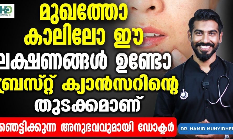 ഫാറ്റി ലിവർ വിട്ടുമാറാതെ നിങ്ങളിൽ കാണുന്നുണ്ടോ?ഇത് ബ്രസ്റ്റ് ക്യാൻസറിന്റെ ഒരു ലക്ഷണം മാത്രമാണ്. കണ്ടു നോക്കൂ…| Breast cancer causes