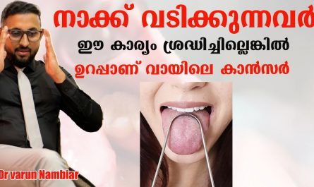 Mouth cancer symptoms