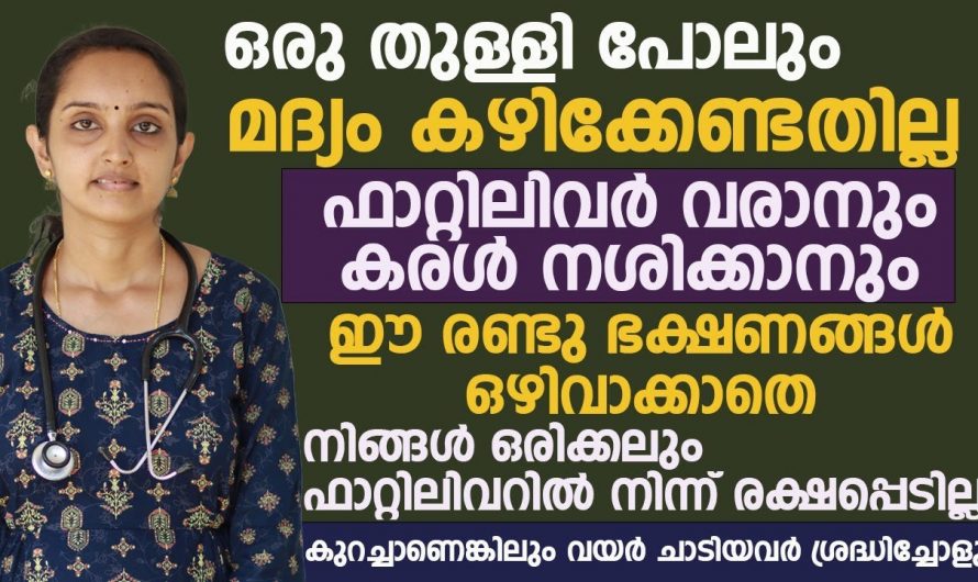 ഫാറ്റി ലിവറിൽ നിന്നുള്ള മോചനം ആഗ്രഹിക്കുന്നവരാണോ നിങ്ങൾ ? എങ്കിൽ ഇത്തരം കാര്യങ്ങൾ അറിയാതെ പോകരുതേ…| Best 2 medication for fatty liver