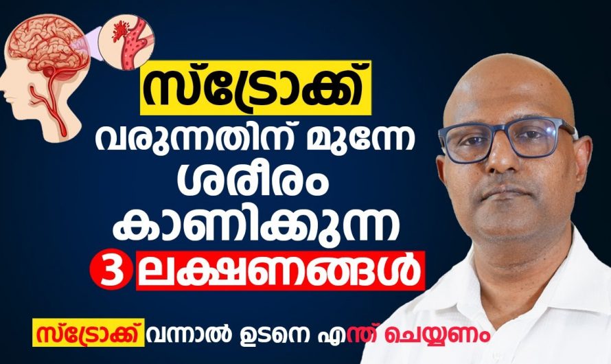 ശരീരത്തിൽ പെട്ടെന്ന് കാണുന്ന ഇത്തരം ലക്ഷണങ്ങളെ ആരും അവഗണിക്കരുതേ. ഇത് നമ്മുടെ ജീവന് തന്നെ ഭീഷണി ആകാം കണ്ടു നോക്കൂ…| Stroke symptoms