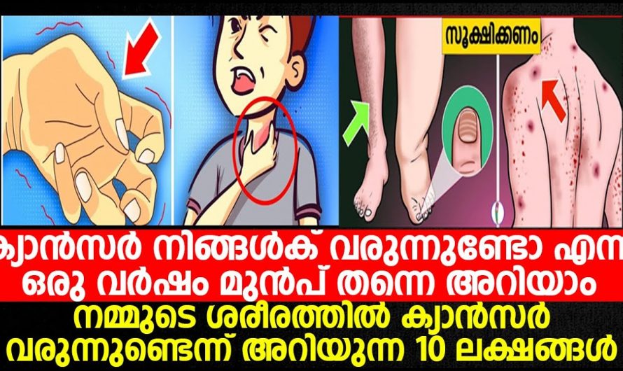 അകാരണമായി ശരീരഭാരം കുറഞ്ഞുവരുന്നതായി അനുഭവപ്പെടാറുണ്ടോ? ഇതിനെ ആരും കണ്ടില്ല എന്ന് നടിക്കരുതേ…| Hidden cancer symptoms