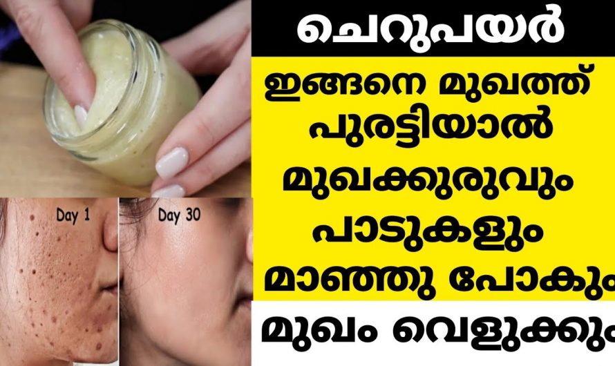 മുഖക്കുരുവിനെയും മുഖക്കുരുവിന്റെ പാടുകളെയും ഒരുപോലെ മായ്ച്ചു കളയാൻ ഇത് ഒരു പിടി മതി.  ഇതിന്റെ നേട്ടങ്ങളെ ആരും തിരിച്ചറിയാതെ പോകരുതേ…| Chickpea face mask benefits