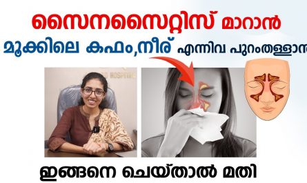 Sinusitis treatment malayalam
