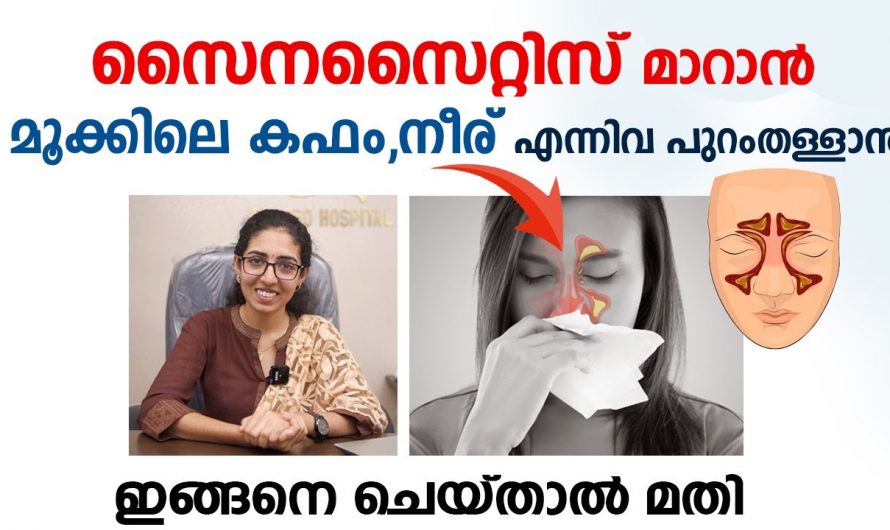 സൈനസൈറ്റിസിനെ പൂർണമായും മറികടക്കുന്നതിന് വേണ്ടിയുള്ള ഇത്തരം കാര്യങ്ങൾ ഇതുവരെയും അറിയാതെ പോയല്ലോ. കണ്ടു നോക്കൂ…| Sinusitis treatment malayalam