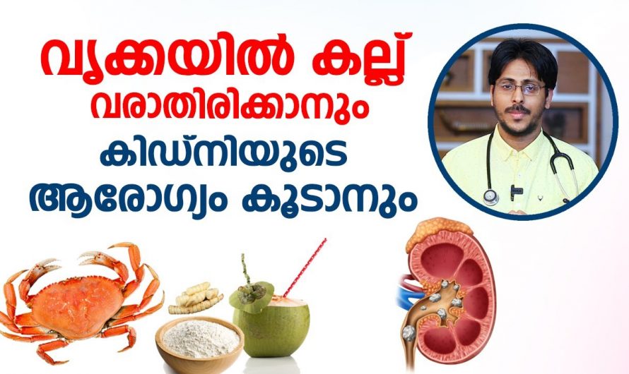 മൂത്രത്തിലെ എത്ര വലിയ കല്ലിനെയും ഇല്ലാതാക്കാൻ ഇത്രമാത്രം ചെയ്താൽ മതി. കണ്ടു നോക്കൂ…| Kidney stone food