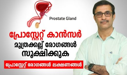Prostate Cancer and Kidney Stone