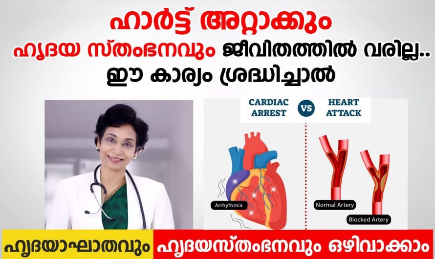 ജീവിതത്തിൽ ഒരിക്കലും ഹൃദയസംബന്ധമായ പ്രശ്നങ്ങൾ വരാതിരിക്കാൻ  ഇത്തരം കാര്യങ്ങൾ ശ്രദ്ധിക്കൂ. ഇതാരും നിസ്സാരമായി തള്ളിക്കളയരുതേ…| All about Heart Attack And Cardiac Arrest