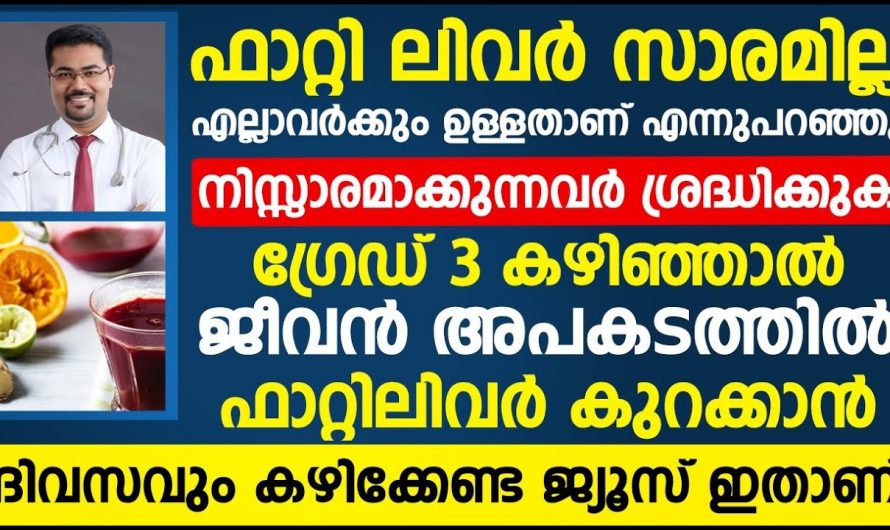 ഫാറ്റിലിവറിനെ ആരും നിസ്സാരമായി കാണേണ്ട. ഇതുണ്ടാക്കുന്ന ബുദ്ധിമുട്ടുകൾ മരണത്തിലേക്കാണ് നയിക്കുന്നത്. കണ്ടു നോക്കൂ…| Fatty liver grade 3 treatment