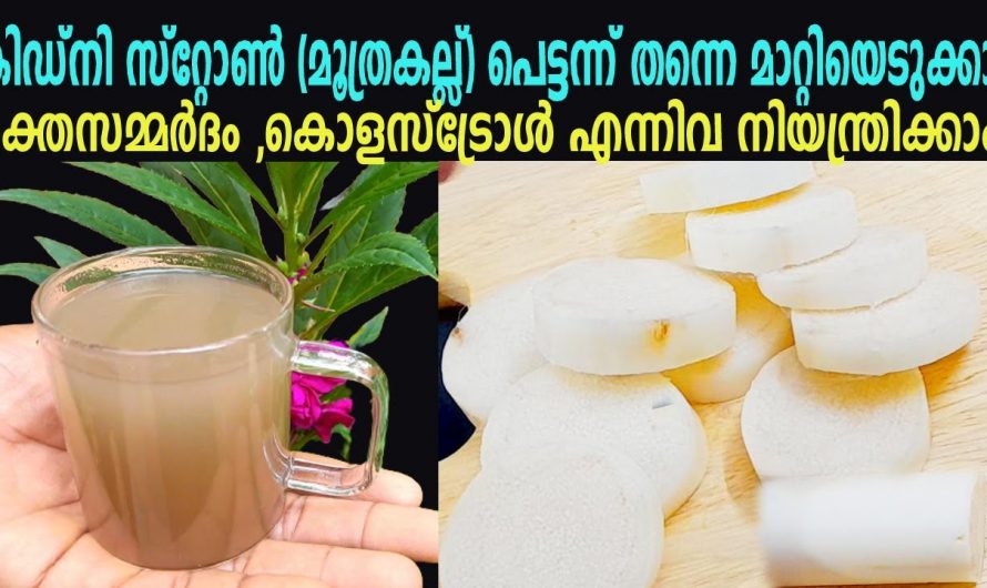 എത്ര വലിയ കിഡ്നി സ്റ്റോണിനെയും അലിയിച്ചു കളയാൻ ഈയൊരു ഡ്രിങ്ക് മതി. കണ്ടു നോക്കൂ…| Kidney stone pain relief