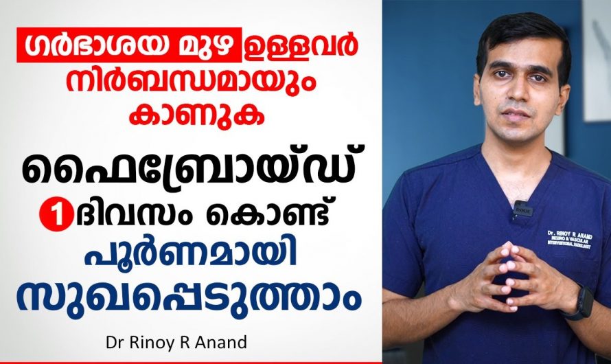 ഗർഭാശയ മുഴകളെ കരിയിച്ചു കളയുന്നതിനുള്ള ഇത്തരം മാർഗങ്ങളെ ആരും തിരിച്ചറിയാതെ പോകല്ലേ…| Fibroid Treatment Malayalam