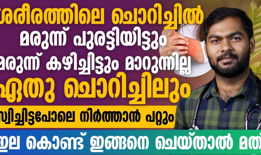 അസഹ്യമായ ചൊറിച്ചിലിനൊപ്പം ചർമം കട്ടിയാകാറുണ്ടോ?  ഇതിന്റെ പിന്നിലെ യഥാർത്ഥ കാരണങ്ങളെ ആരും കാണാതെ പോകല്ലേ…| Psoriasis symptoms and treatment