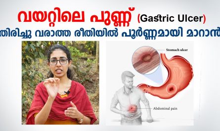 Ulcer home remedy malayalam
