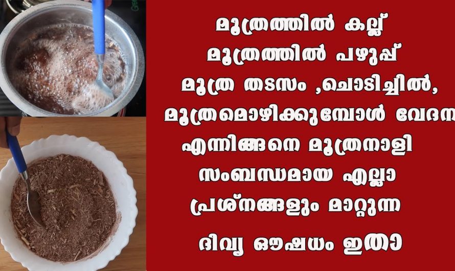 മൂത്രാശയെ സംബന്ധമായുള്ള എല്ലാ രോഗങ്ങളെ ചെറുക്കുവാനും മൂത്ര തടസ്സം ഇല്ലായ്മ ചെയ്യാനും ഈയൊരു ഒറ്റമൂലി മതി. ഇതാരും അറിയാതെ പോകല്ലേ…| Urine infection symptoms