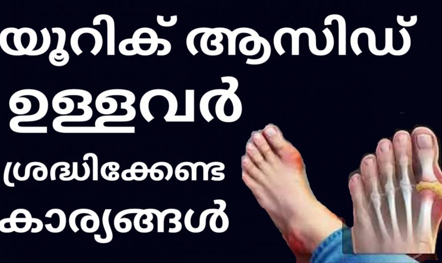 യൂറിക്കാസിഡിനെ പൂർണമായും ഒഴിവാക്കാൻ കഴിക്കേണ്ട ഭക്ഷണങ്ങളെക്കുറിച്ച് ഇതുവരെയും അറിയാതെ പോയല്ലോ. കണ്ടു നോക്കൂ…| Uric Acid Treatment Malayalam