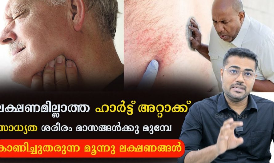 ഹാർട്ട് അറ്റാക്ക് വരുമ്പോൾ കഠിനമായ നെഞ്ച് വേദനയോടൊപ്പം കാണുന്ന ഇത്തരം ലക്ഷണങ്ങളെ ആരും തിരിച്ചറിയാതെ പോകരുതേ…| Potential for silent attack