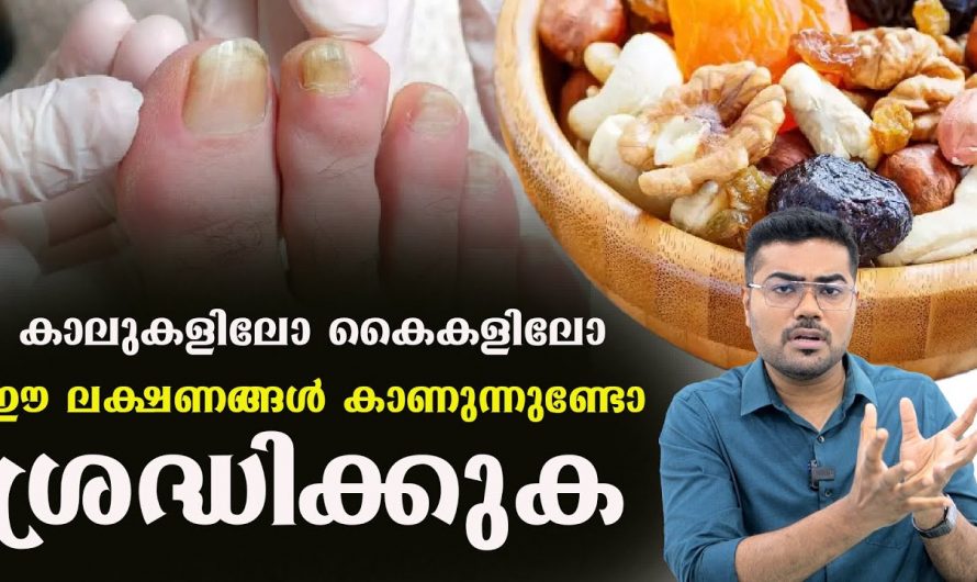 കൈകളിലും കാലുകളിലും അധികമായി കാണുന്ന ഫംഗസ് രോഗങ്ങളെ ചെറുക്കുവാൻ ഇത്തരം കാര്യങ്ങൾ ആരും നിസ്സാരമായി കാണരുതേ.