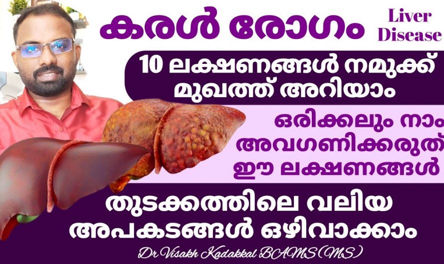 കരൾ രോഗങ്ങൾക്ക് ശരീരം കാണിക്കുന്ന ഇത്തരം ലക്ഷണങ്ങളെ ആരും തിരിച്ചറിയാതെ പോകരുതേ…| Early signs & symptoms of Liver Disease