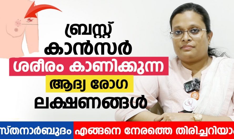 സ്തനാർബുധത്തിന് ശരീരം പ്രകടമാക്കുന്ന ഇത്തരം ലക്ഷണങ്ങളെ ആരും തിരിച്ചറിയാതെ പോകരുതേ…| Breast Cancer Symptoms Types Causes