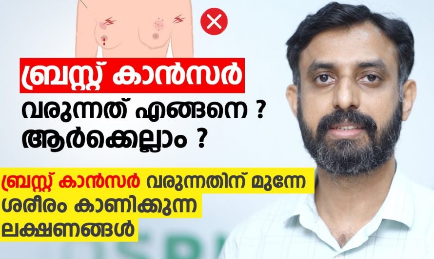 ബ്രസ്റ്റ് കാൻസറിനെ പെട്ടെന്ന് തന്നെ തിരിച്ചറിയാൻ ഇത്തരം ലക്ഷണങ്ങളെ ആരും നിസ്സാരമായി കാണരുതേ…| Breast cancer symptoms in malayalam