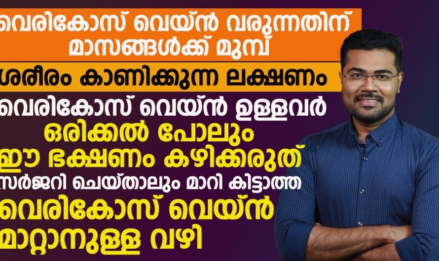 വെരിക്കോസ് വെയിനിന്റെ ഇത്തരം  ലക്ഷണങ്ങളെ തിരിച്ചറിയാതെ പോയാൽ തീരാനഷ്ടം ആയിരിക്കും ഫലം. കണ്ടു നോക്കൂ…| Varicose veins treatment