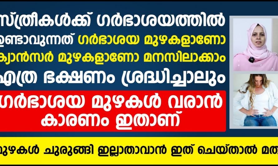 ഗർഭാശയ മുഴകൾ ചുരുങ്ങി ഇല്ലാതാവാൻ ഇത്ര മാത്രം ചെയ്താൽ മതി. കണ്ടു നോക്കൂ.