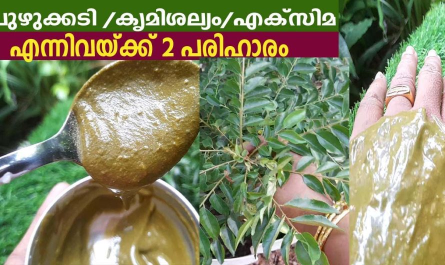 ഇതൊരു തണ്ട് മതി കൃമിശല്യം പുഴുക്കടി എക്സിമ എന്നിവയെ പൂർണമായും അകറ്റാൻ. ഇതാരും കണ്ടില്ലെന്ന് നടിക്കരുതേ…| Fungal Infection and Itching