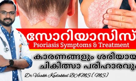 Psoriasis Symptoms & Treatment