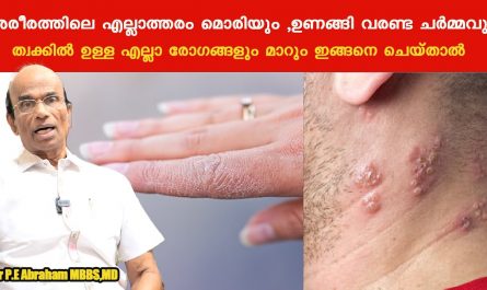 Skin diseases treatment at home