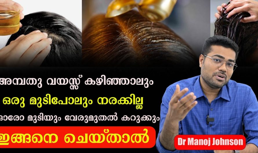 20കൾ കഴിയുമ്പോഴേക്കും മുടികൾ നരച്ചു തുടങ്ങിയോ? എങ്കിൽ ഇത്തരം കാരണങ്ങളെ തിരിച്ചറിയാതെ പോകല്ലേ.