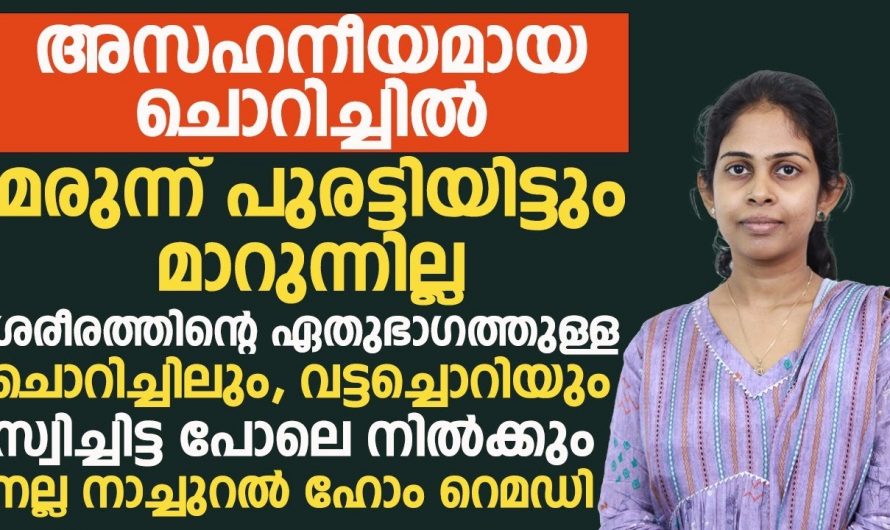 ഫംഗസ് ഇൻഫെക്ഷനുകളെ മറികടക്കാൻ ഇത്രയ്ക്ക് എളുപ്പമായിരുന്നോ? കണ്ടു നോക്കൂ…| Fungal infection on skin