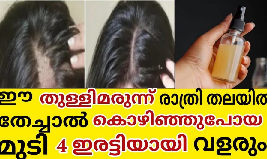 കൊഴിഞ്ഞുപോയ മുടികളെ നോക്കി ഇനി ആശങ്കപ്പെടേണ്ട. ഈ ടോണർ ഉപയോഗിക്കൂ. മാറ്റം സ്വയം തിരിച്ചറിയൂ.