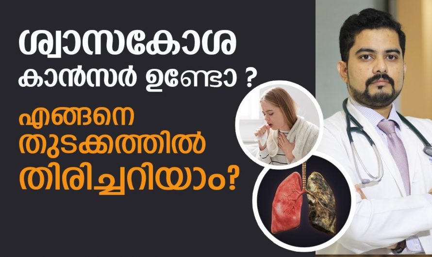 ശ്വാസകോശ ക്യാൻസറിനെ ശരീരം കാണിക്കുന്ന ഇത്തരം ലക്ഷണങ്ങളെ ഇതുവരെയും അറിയാതെ പോയല്ലോ.