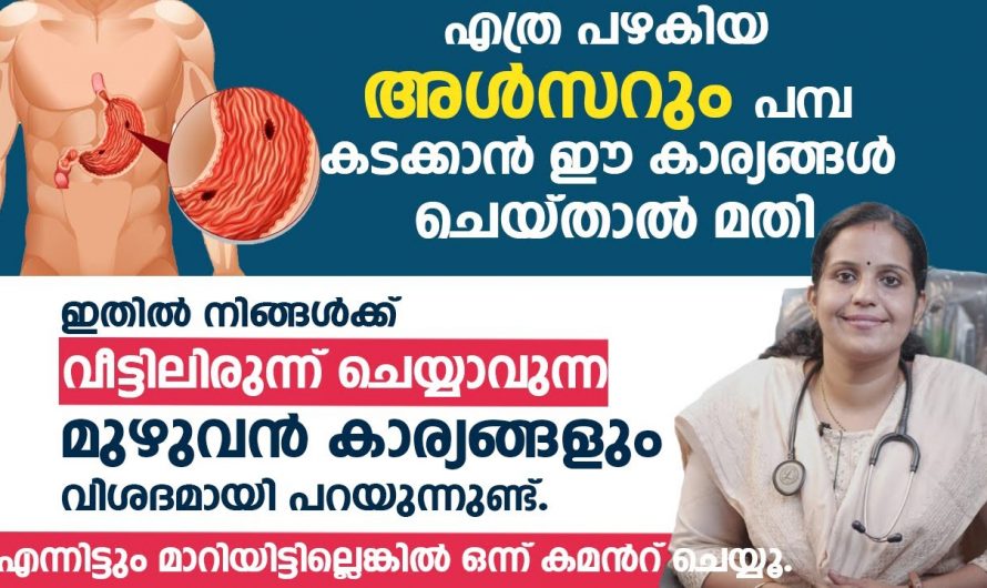 വയറിലെ അൾസറിന്റെ യഥാർത്ഥ കാരണങ്ങളെ ആരും തിരിച്ചറിയാതെ പോകരുതേ.