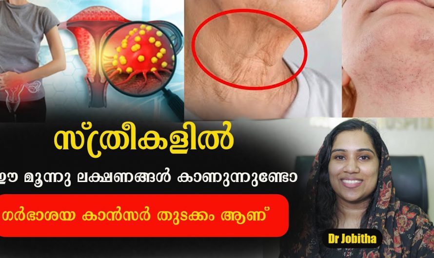 സർവിക്കൽ കാൻസറിന്റെ ലക്ഷണങ്ങളെ ആരും തിരിച്ചറിഞ്ഞില്ലെങ്കിൽ തീരാ നഷ്ടമായിരിക്കും ഫലം. കണ്ടു നോക്കൂ…| Symptoms of cervical cancer