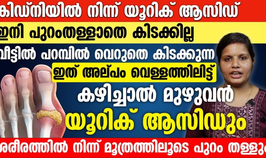 യൂറിക്കാസിഡാണോ നിങ്ങളുടെ പ്രശ്നം? എങ്കിൽ പരിഹാരം മാർഗ്ഗം ദാ ഇവിടെയുണ്ട്. കണ്ടു നോക്കൂ…| Uric acid normal level malayalam