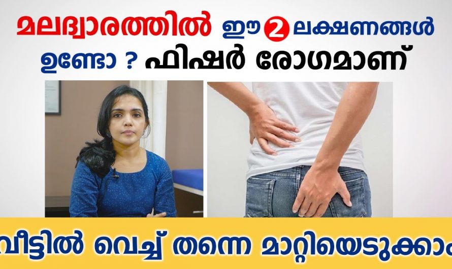 ഫിഷറിനെയും പൈൽസിനെയും എങ്ങനെ തിരിച്ചറിയാം. ഇത് കണ്ടു നോക്കൂ.